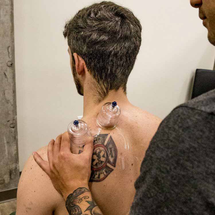 cupping therapy green lake