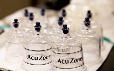 How Cupping Can Lead to a Healthy Back