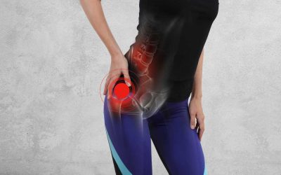 Chiropractic Can Help Women with Hip Pain