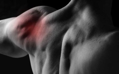 Thoracic Outlet Syndrome: Finding Relief Through Chiropractic Care