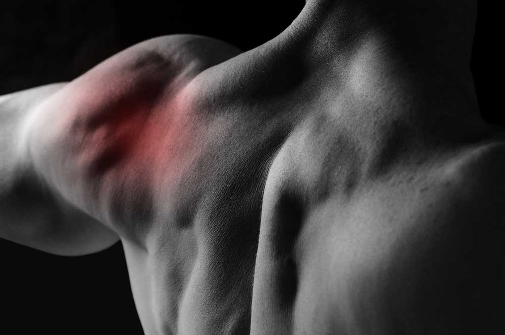 Thoracic Outlet Syndrome