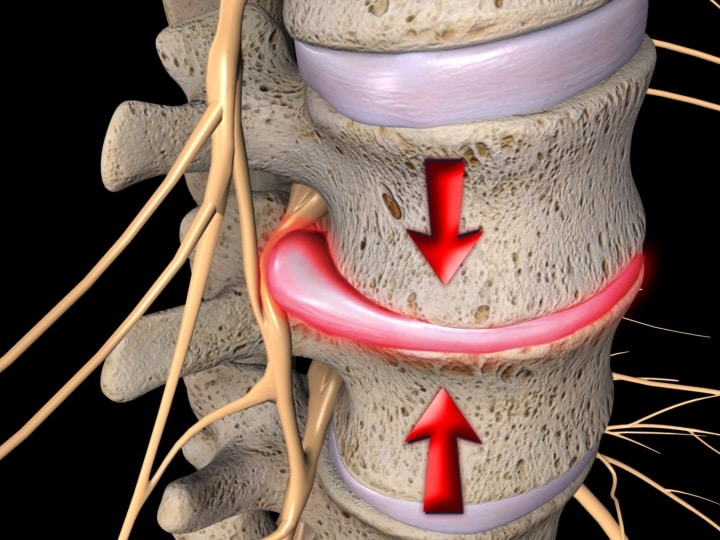 spine.2